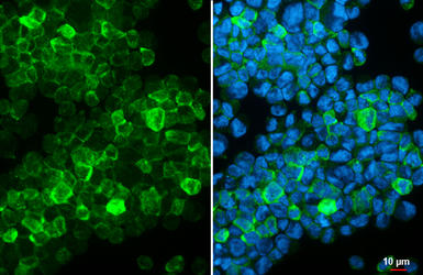 Anti-CX3CR1 antibody [HL4701] used in Immunocytochemistry/ Immunofluorescence (ICC/IF). GTX644702